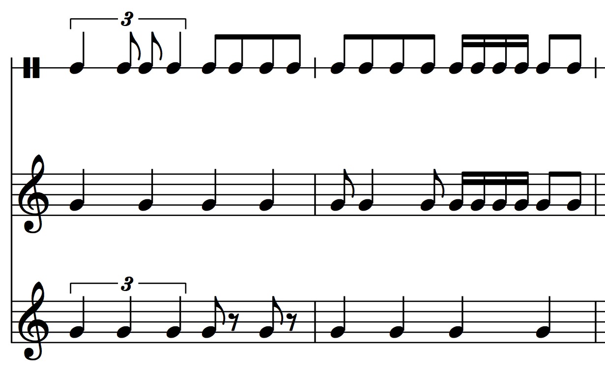 What Is The Music Term For How To Approach A Note Rhythmically